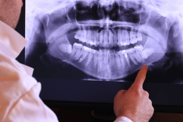 Best Weekend Emergency Dental Services in Wofford Heights, CA